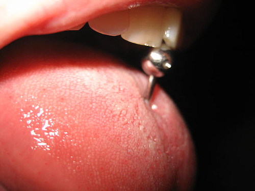 oral piercings. For tongue piercing can cause